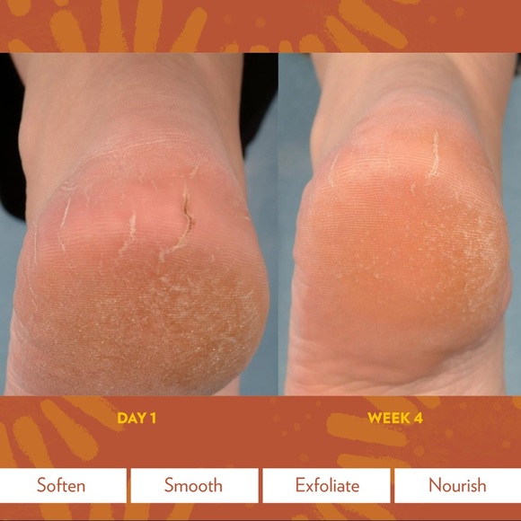2 Packs- Epoch Sole Solution Foot treatment - Picture 3 of 4